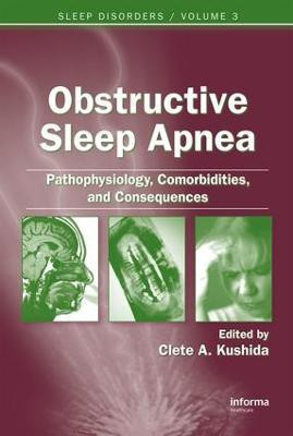 Obstructive Sleep Apnea: Pathophysiology, Comorbidities and Consequences(English, Electronic book text, unknown)