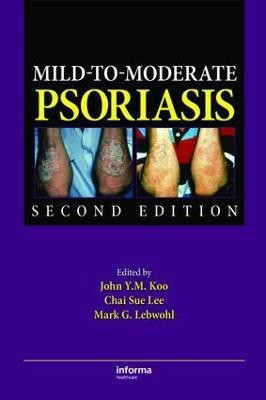 Mild-to-Moderate Psoriasis(English, Electronic book text, unknown)