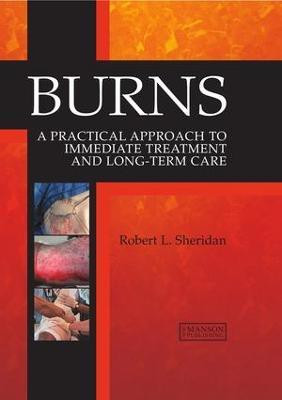 Burns(English, Electronic book text, Sheridan Robert L.)