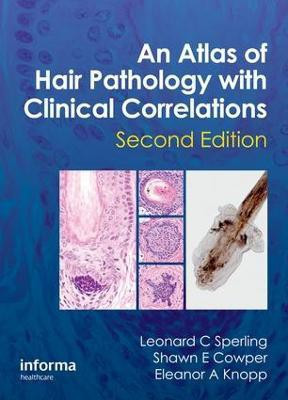 An Atlas of Hair Pathology with Clinical Correlations(English, Electronic book text, Sperling Leonard C)