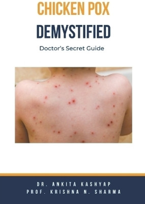Chickenpox Demystified(English, Paperback, Kashyap Ankita Dr)