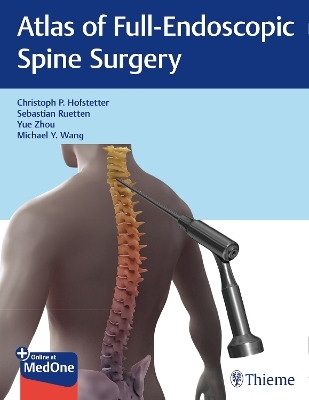 Atlas of Full-Endoscopic Spine Surgery(English, Electronic book text, Hofstetter Christoph)