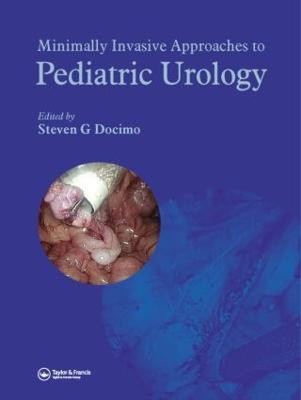 Minimally Invasive Approaches to Pediatric Urology(English, Hardcover, unknown)
