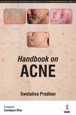 Handbook on Acne(English, Paperback, Pradhan Swetalina)