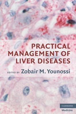 Practical Management of Liver Diseases(English, Hardcover, unknown)