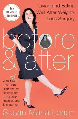 Before & After, Second Revised Edition(English, Paperback, unknown)