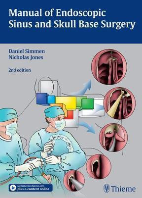 Manual of Endoscopic Sinus and Skull Base Surgery(English, Hardcover, unknown)