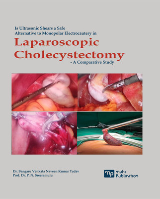 Is Ultrasonic Shears A Safe Alternative To Monopolar Electrocautery In Laparoscopic Cholecystectomy - A Comparative Study(Paperback, DR. BANGARU VENKATA NAVEEN KUMAR YADAV, PROF. DR. P. N. SREERAMULU)