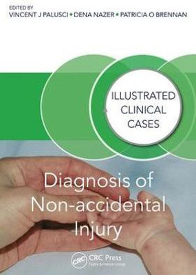 Diagnosis of Non-accidental Injury(English, Electronic book text, unknown)