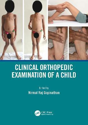Clinical Orthopedic Examination of a Child(English, Paperback, unknown)