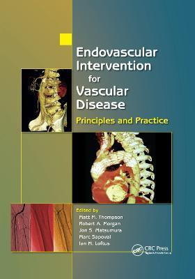 Endovascular Intervention for Vascular Disease(English, Paperback, unknown)