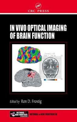 In Vivo Optical Imaging of Brain Function(English, Electronic book text, unknown)