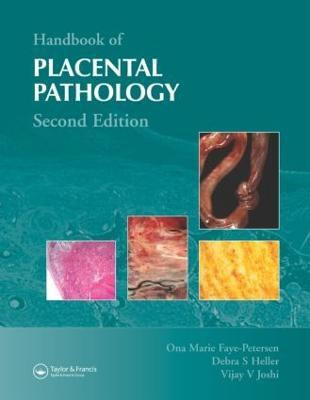 Handbook of Placental Pathology(English, Hardcover, Faye-Petersen Ona Marie)