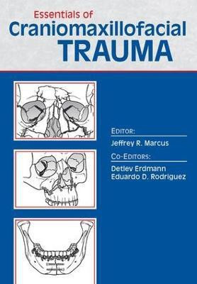 Essentials of Craniomaxillofacial Trauma(English, Electronic book text, unknown)