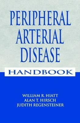 Peripheral Arterial Disease Handbook(English, Paperback, unknown)