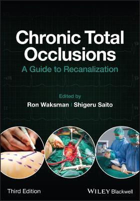 Chronic Total Occlusions(English, Hardcover, unknown)