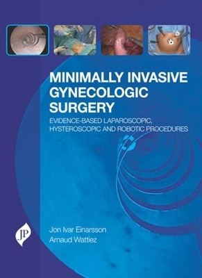 Minimally Invasive Gynecologic Surgery: Evidence-Based Laparoscopic, Hysteroscopic & Robotic Surgeries(English, Hardcover, Einarsson Jon Ivar)