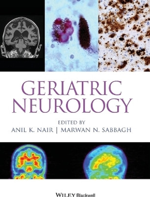 Geriatric Neurology(English, Hardcover, unknown)