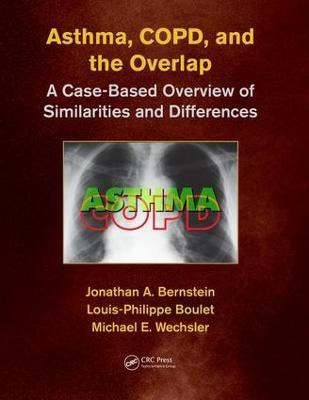 Asthma, COPD, and Overlap(English, Paperback, unknown)