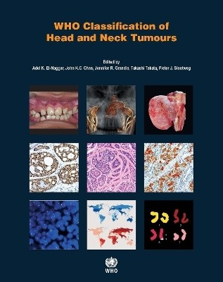 WHO classification of head and neck tumours(English, Paperback, International Agency for Research on Cancer)