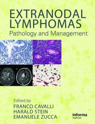 Extranodal Lymphomas(English, Hardcover, unknown)