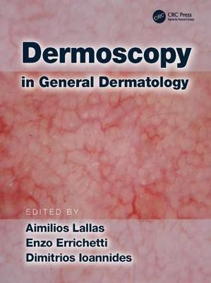 Dermoscopy in General Dermatology(English, Hardcover, unknown)