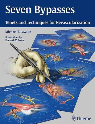 Seven Bypasses(English, Hardcover, Lawton Michael T.)