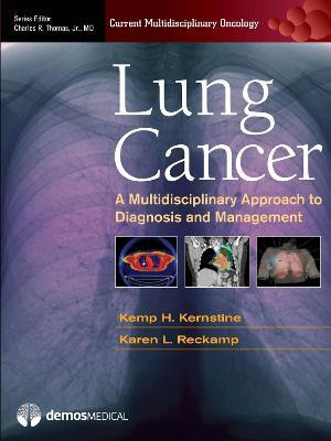 Lung Cancer(English, Hardcover, unknown)