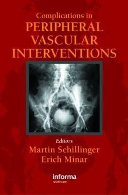 Complicatons in Peripheral Vascular Interventions(English, Hardcover, unknown)