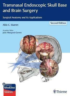 Transnasal Endoscopic Skull Base and Brain Surgery(English, Mixed media product, unknown)