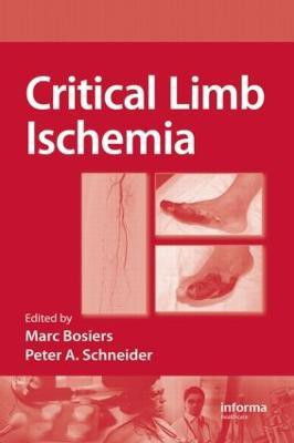 Critical Limb Ischemia(English, Hardcover, unknown)