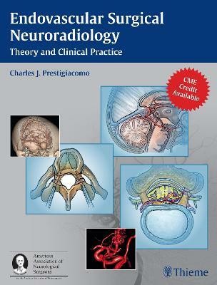 Endovascular Surgical Neuroradiology(English, Hardcover, unknown)