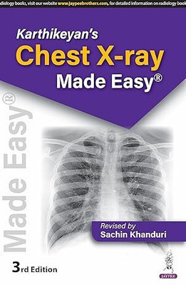 Karthikeyan's Chest X-Ray Made Easy(Paperback, Sachin Khanduri)