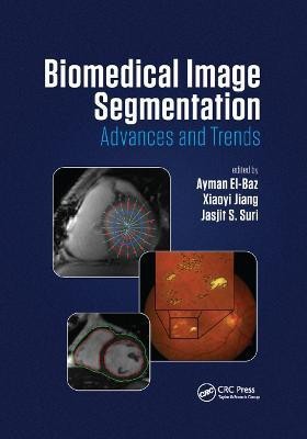 Biomedical Image Segmentation(English, Paperback, unknown)