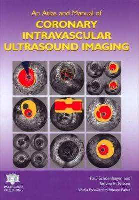 An Atlas and Manual of Coronary Intravascular Ultrasound Imaging(English, Hardcover, unknown)
