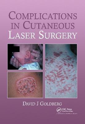 Complications in Laser Cutaneous Surgery(English, Hardcover, Goldberg David J.)