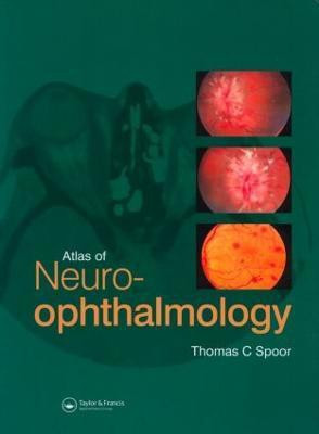 Atlas of Neuro-ophthalmology(English, Hardcover, Spoor Thomas C.)