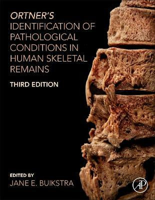 Ortner's Identification of Pathological Conditions in Human Skeletal Remains(English, Hardcover, unknown)