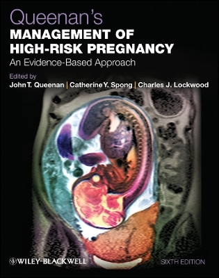 Queenan's Management of High-Risk Pregnancy - An Evidence-Based Approach 6e(English, Other digital, Queenan J)