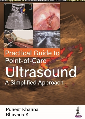 Practical Guide to Point-of-Care Ultrasound(English, Paperback, Khanna Puneet)
