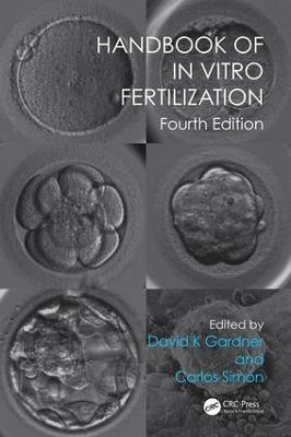 Handbook of In Vitro Fertilization(English, Paperback, unknown)