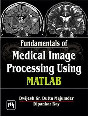 Fundamentals of Medical Image Processing Using Matlab(English, Paperback, MAJUMDER DWIJESH KUMAR DUTTA)
