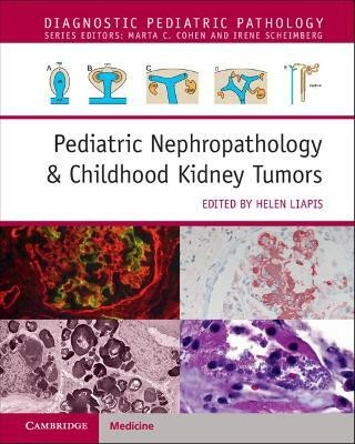 Pediatric Nephropathology & Childhood Kidney Tumors with Online Resource(English, Mixed media product, unknown)