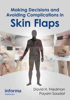 Making Decisions and Avoiding Complications in Skin Flaps(English, Electronic book text, unknown)