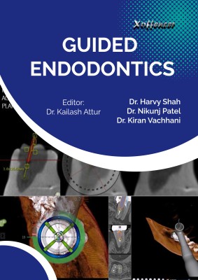 GUIDED ENDODONTICS(Paperback, Dr. Harvy Shah, Dr. Nikunj Patel, Dr. Kiran Vachhani)