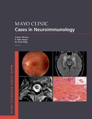 Mayo Clinic Cases in Neuroimmunology(English, Paperback, McKeon Andrew)