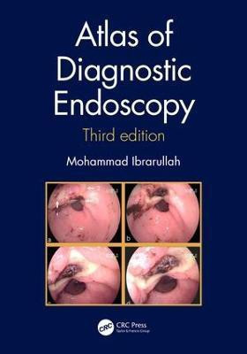 Atlas of Diagnostic Endoscopy, 3E(English, Electronic book text, Ibrarullah Mohammad)