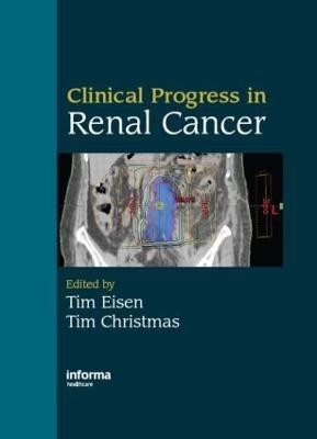 Clinical Progress in Renal Cancer(English, Hardcover, unknown)