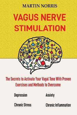 Vagus Nerve Stimulation(English, Paperback, Norris Martin)