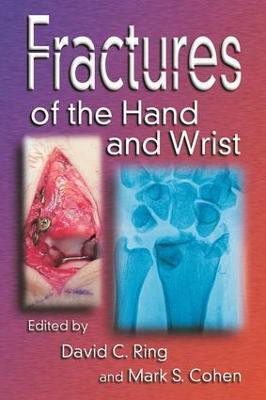 Fractures of the Hand and Wrist(English, Electronic book text, unknown)
